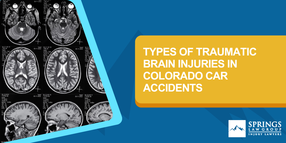 Types of Traumatic Brain Injuries in Colorado Car Accidents; why are traumatic brain injuries different; Types of Traumatic Brain Injuries in Colorado Car Accidents
