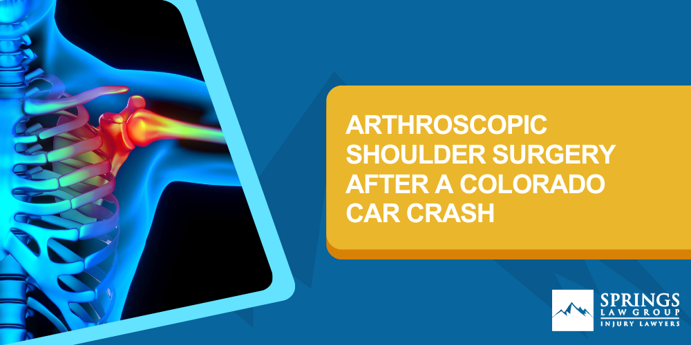 common shoulder injuries from colorado car crashes; Arthroscopic Shoulder Surgery After A Car Crash; Do You Need Arthroscopic Shoulder Surgery After A Car Crash_ Call Springs Law Group To Learn How We Can Help;