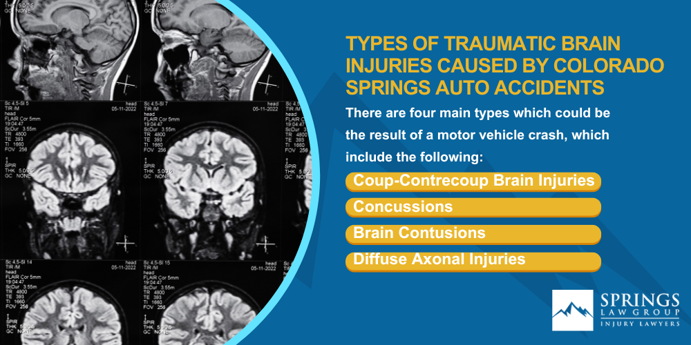 Types Of Traumatic Brain Injuries Caused By Colorado Springs Auto Accidents