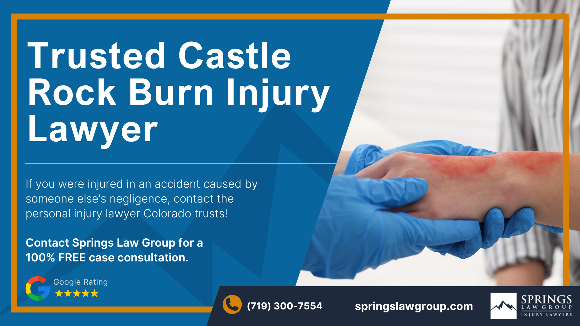 Castle Rock Burn Injury Lawyer; What Kind Of Injuries Can Occur After A Bike Crash; Potential Restrictions On Compensation; Talk To A Castle Rock Burn Injury Attorney Today; Castle Rock Burn Injury Lawyer