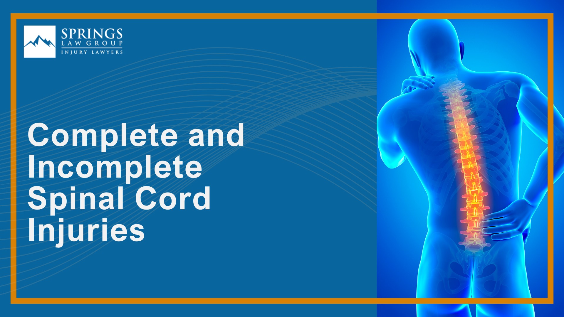 What Is a Spinal Cord Injury Claim; When Someone Else’s Negligence Causes a Spinal Cord Injury; Common Causes of Spinal Cord Injuries; Common Symptoms and Types of Spinal Cord Injuries; Complete and Incomplete Spinal Cord Injuries