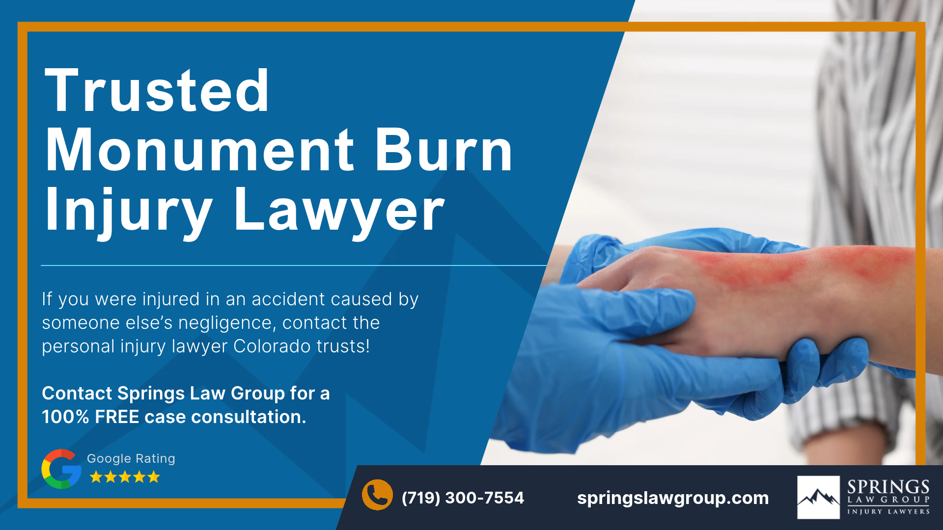 Speak with a Monument Burn Injury Attorney Today; Monument Burn Injury Lawyer