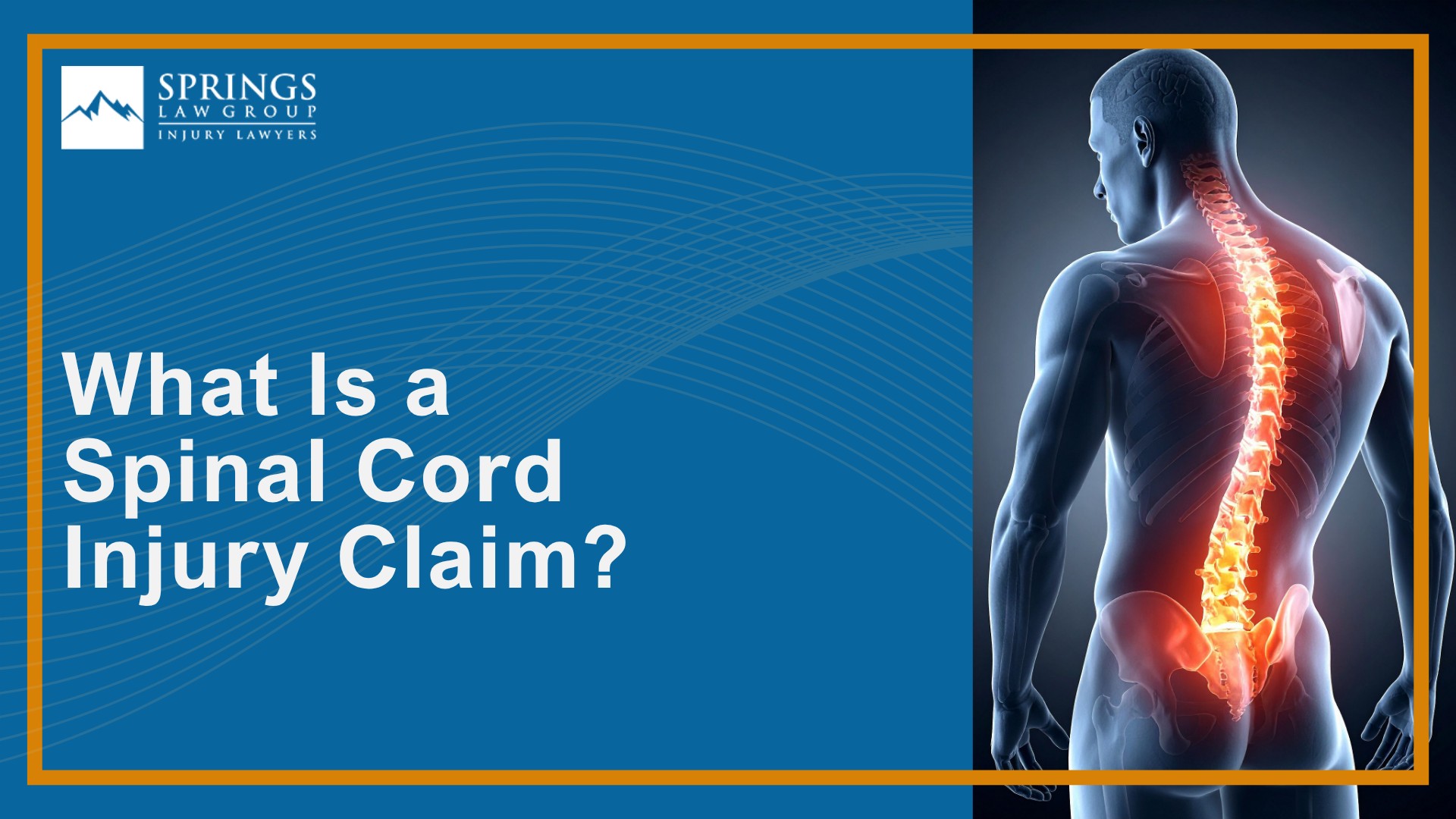 What Is a Spinal Cord Injury Claim