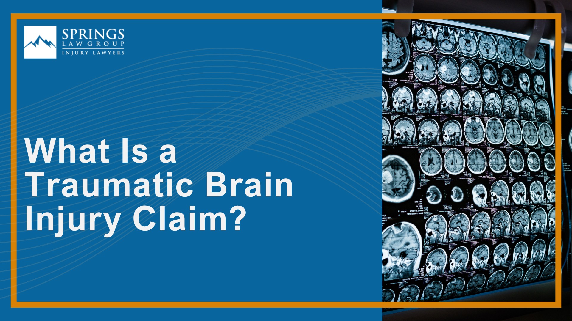 What Is a Traumatic Brain Injury Claim